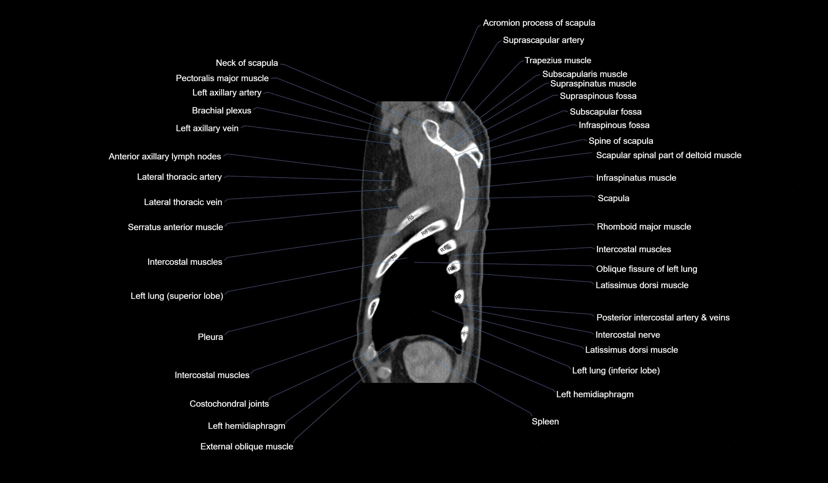 CT chest (thorax) labelled sagittal cross sectional anatomy radiology image-00127.webp